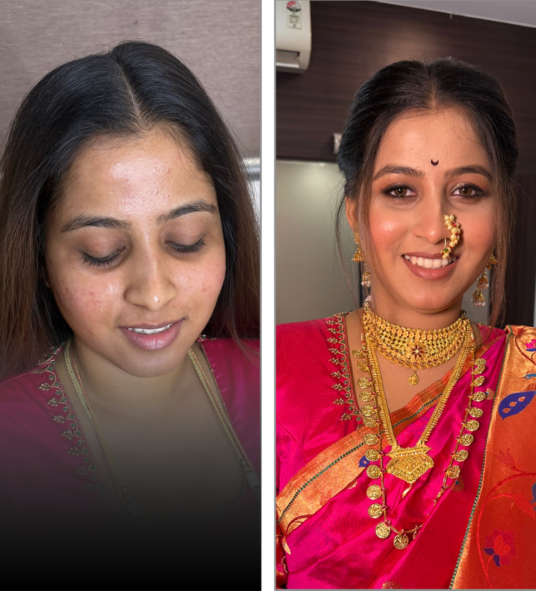 Before and After Bride